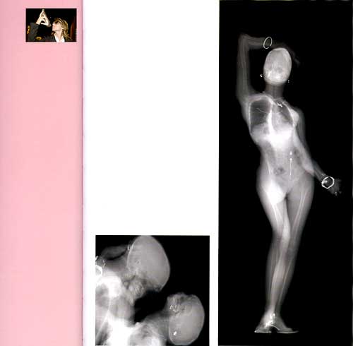 xray